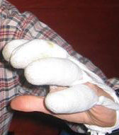 rechte Hand